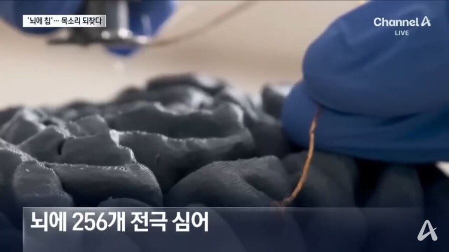 뇌 임플란트 실험 결과 근황_3.jpg