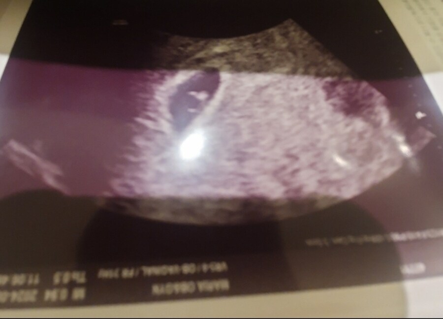 한달 전에 부인 임신시킨 유게이임_2.jpg