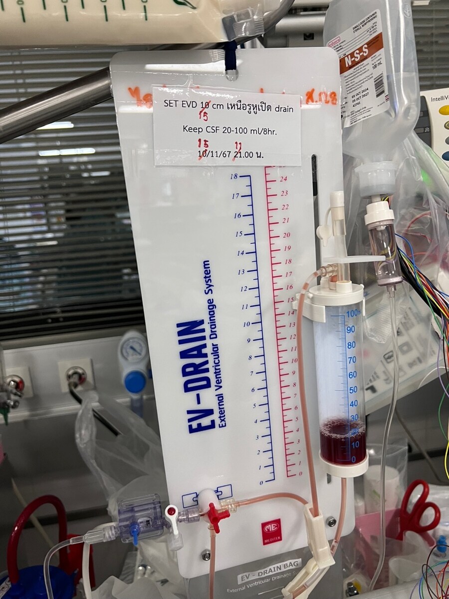 태국에서 쓰러지신 아버지(4편, 지연된 한국 이송)_1.jpg