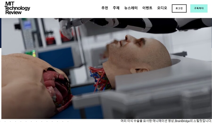 약혐) 한때 전세계 커뮤니티에서 난리 났었던 머리 교체 스타트업_4.jpg