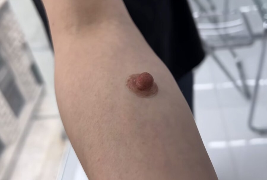 젖 꼭 지 노출_2.jpg