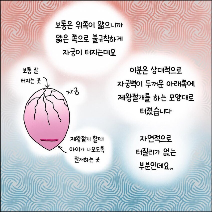 산부인과에서 출산 중 자궁이 파열되는 만화.manhwa_8.jpg