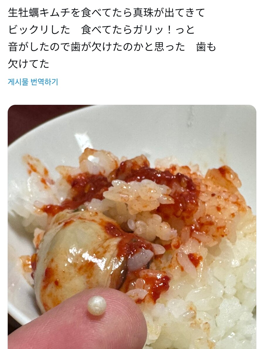 생굴김치 먹다 이빨 깨진사람_1.jpg