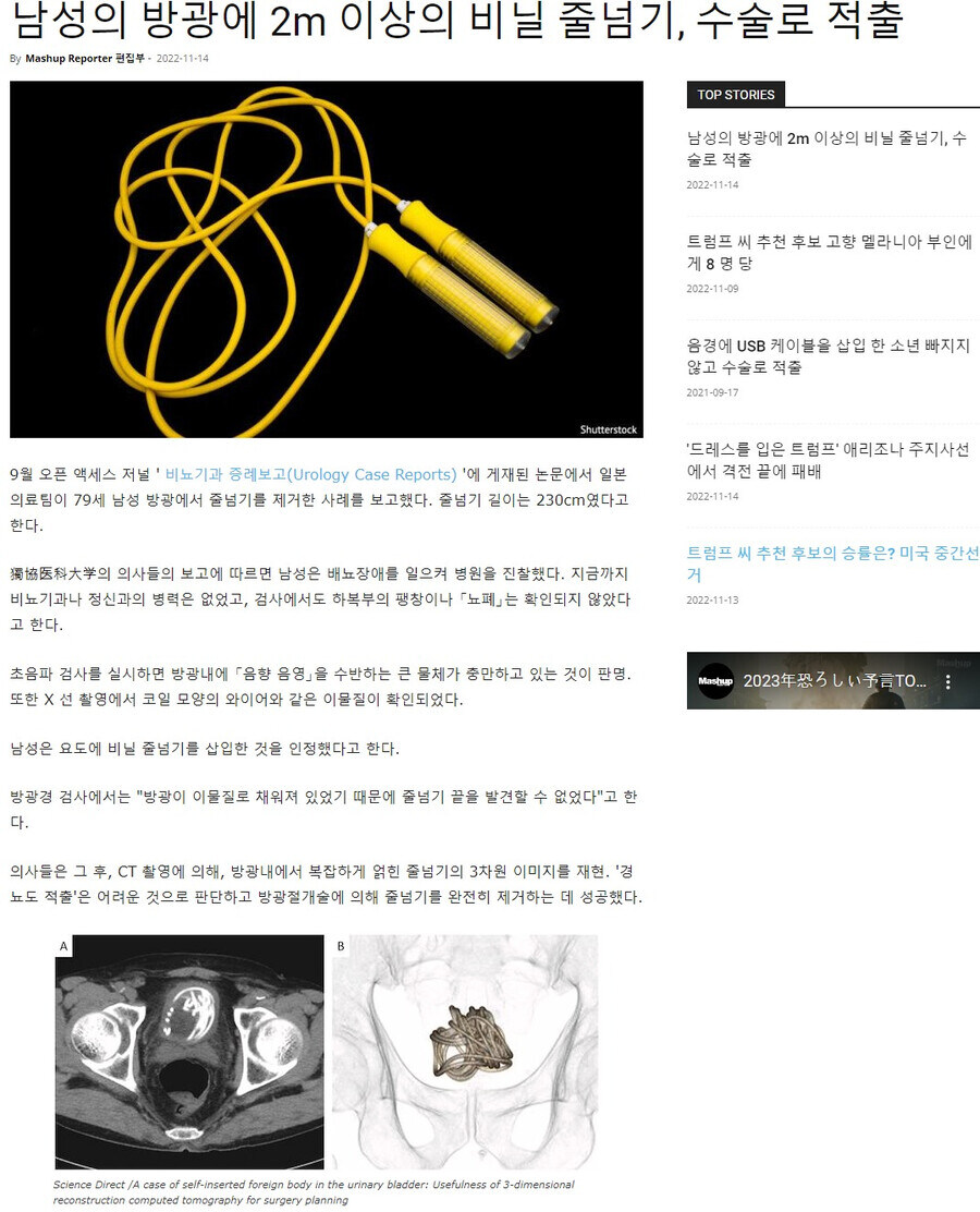 혐)출구를 입구로 사용한 자들의 최후_1.jpg