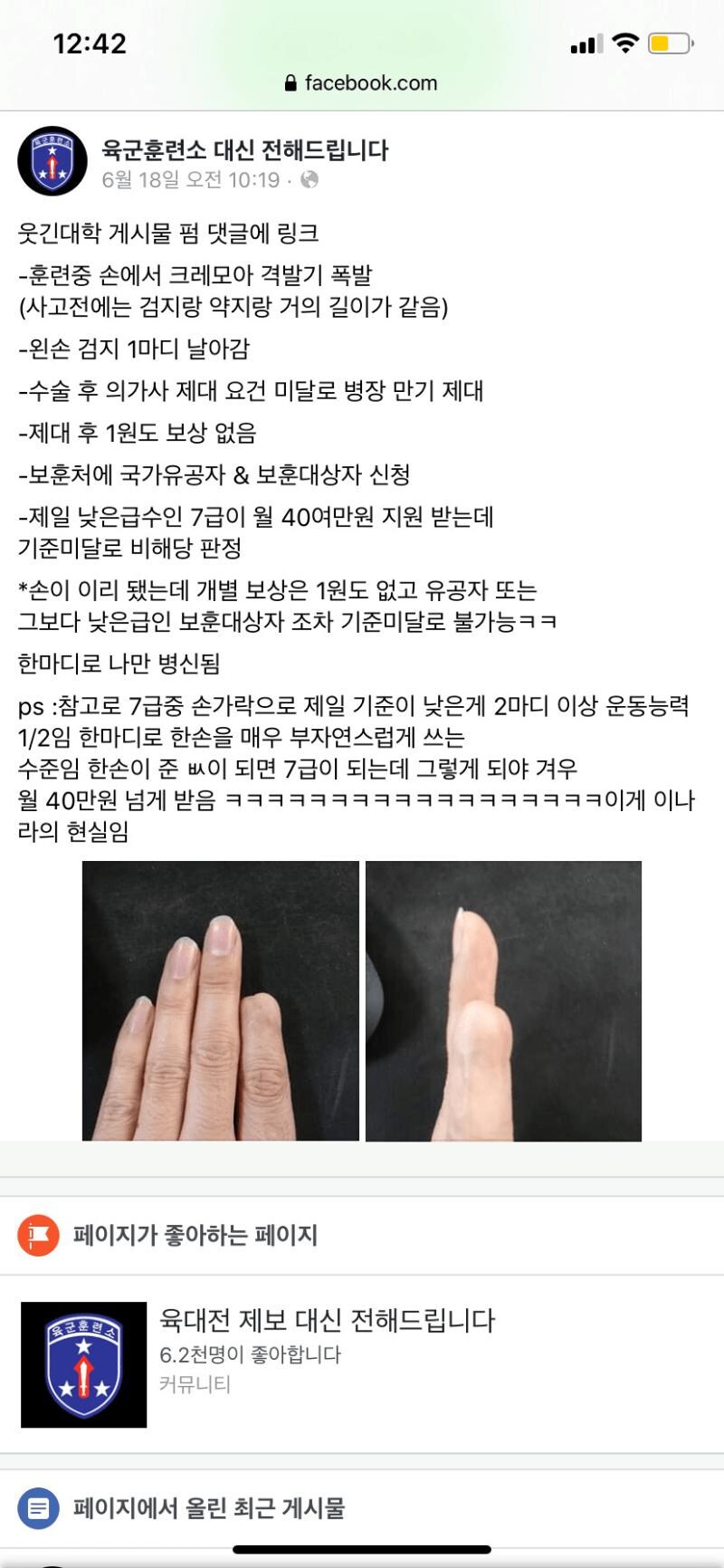 훈련 중 크레모아 격발기 피해 후기_1.jpg