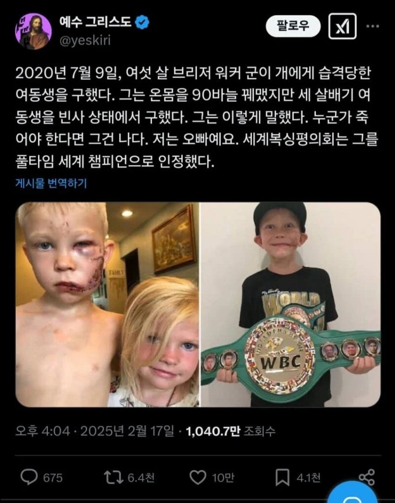 동생을 개로부터 구한 오빠 근황_1.jpg