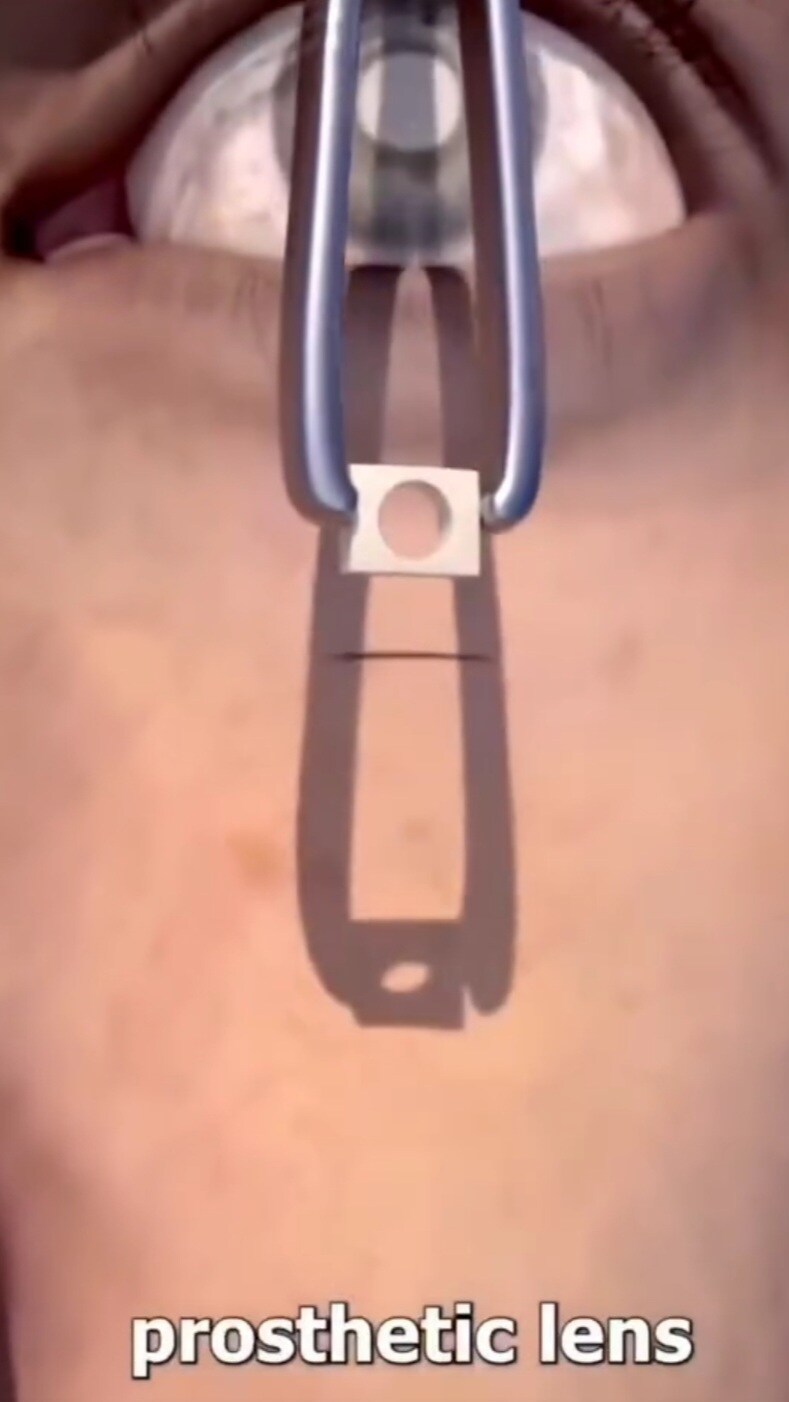 약혐)유게이들 치아 관리 잘하렴_3.jpg