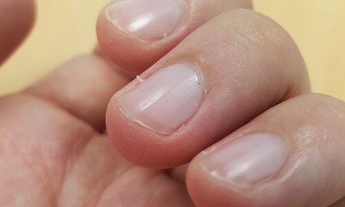 건들면 ↗되는걸 알지만 가만히 못 두는것.jpg_1.jpg