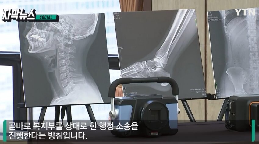 한의사들 X-RAY 무죄 확정 판결 불복시 행정소송도 불사_14.jpg