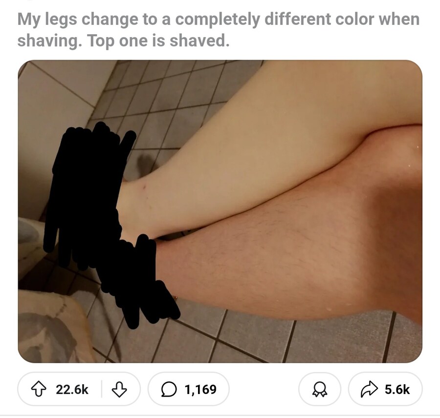 다리털 안밀어본 사람들은 안믿는 민 다리 안 민 다리의 차이_1.jpg