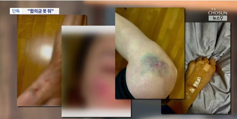 유명 요리사 레스토랑 통창에 깔려 전치 4주…"합의금 못 줘"_3.jpg