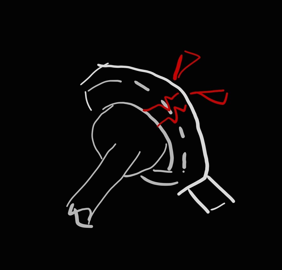 프라모델 만들다보면 제일 짜증나는 구조_1.jpg