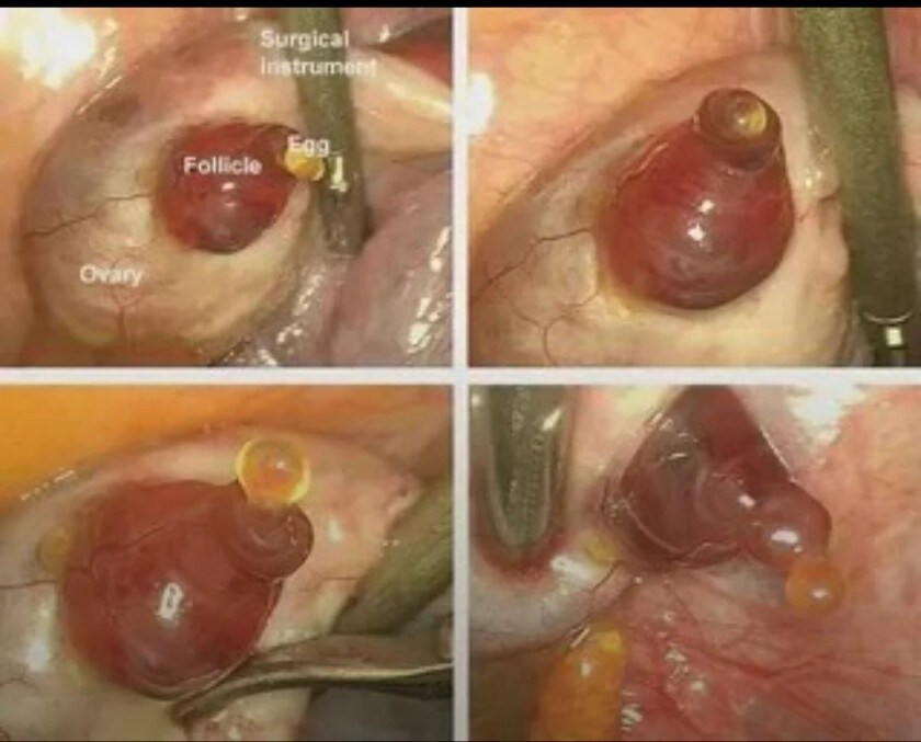 인간의 배란 순간_1.jpg