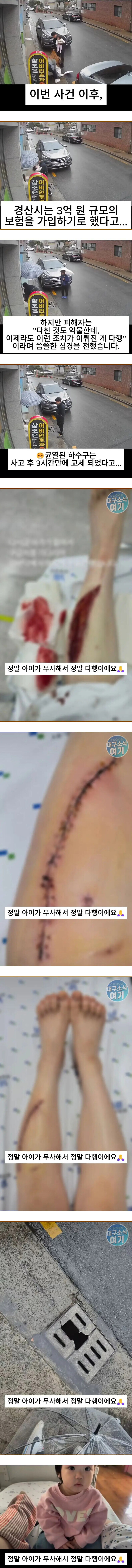 [약혐] 경산 아기엄마의 아찔한 사고_1.jpg