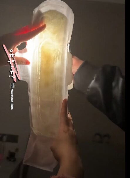 생리대를 빛에 비춰보자 나타난 얼룩덜룩한 자국_6.png