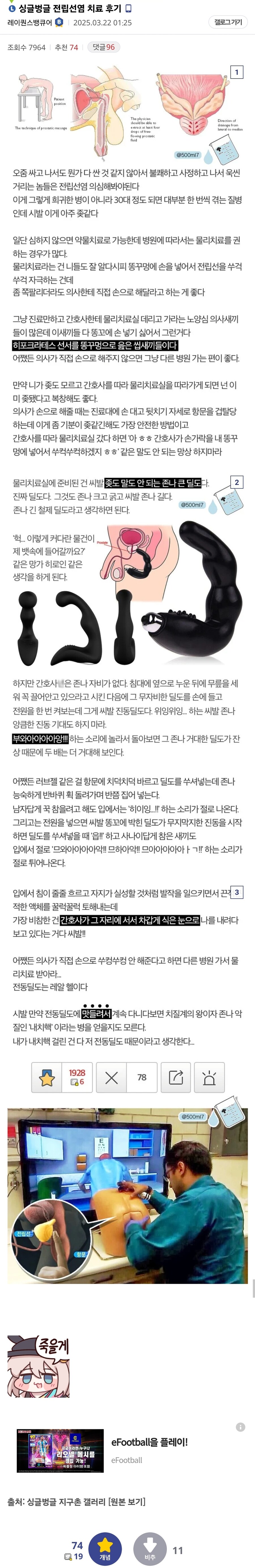 전립선염 치료받은 유게이_1.jpg