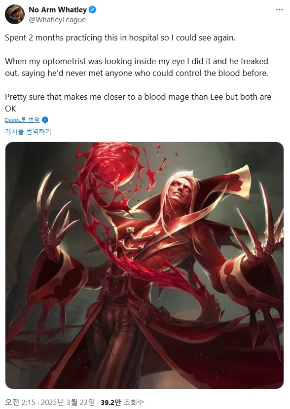 뇌 수술 후 실명한 스트리머가 롤 마스터 복귀함_5.png