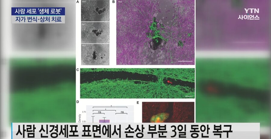 나노머신 근황.jpg_2.jpg