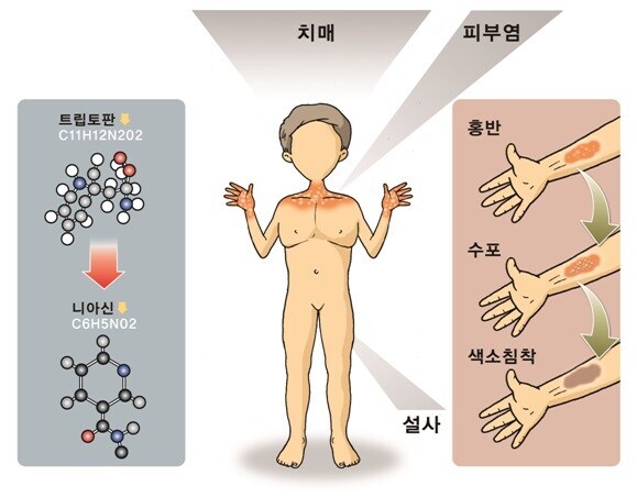 혐?짤주의)누더기글)옥수수와 얽힌 비사_3.jpg