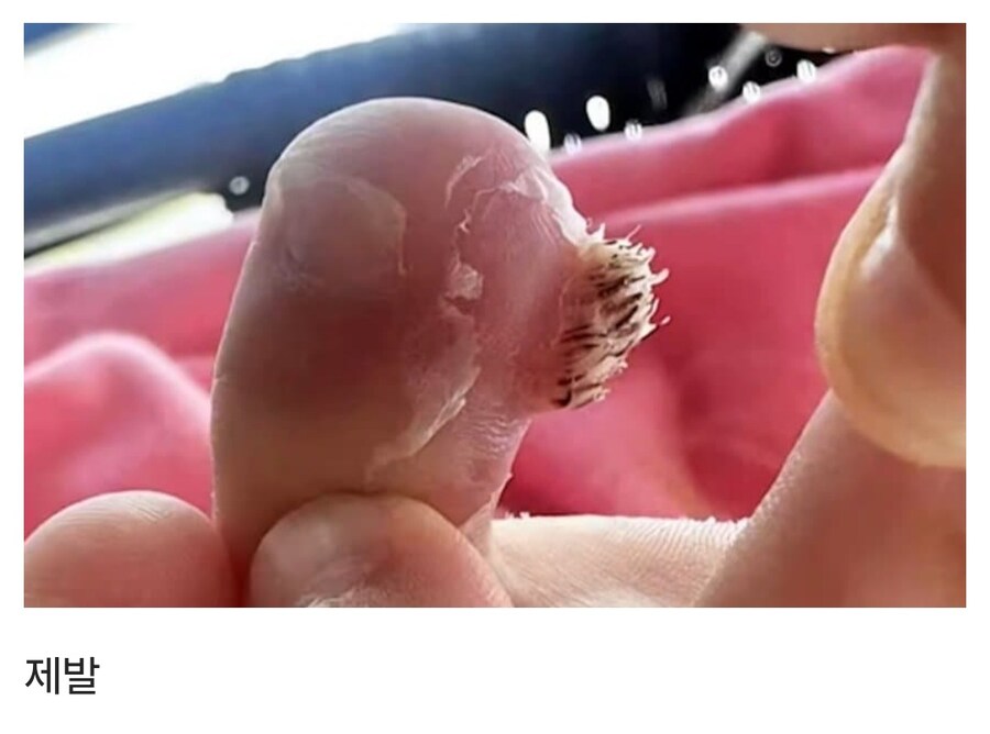 혐) 잠안오는김에 티눈갤보는데_2.jpg