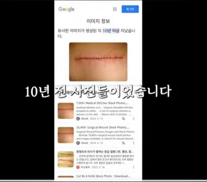 가세연 제보자 피습당한 사진 공개.jpg_4.jpg