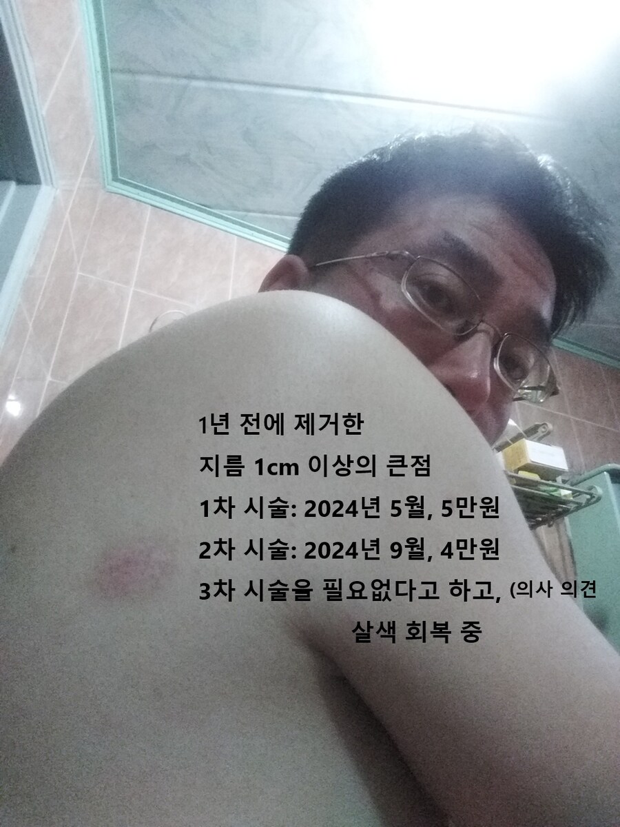 0522 운동일지: "레이저 대공세" 편_28.jpg