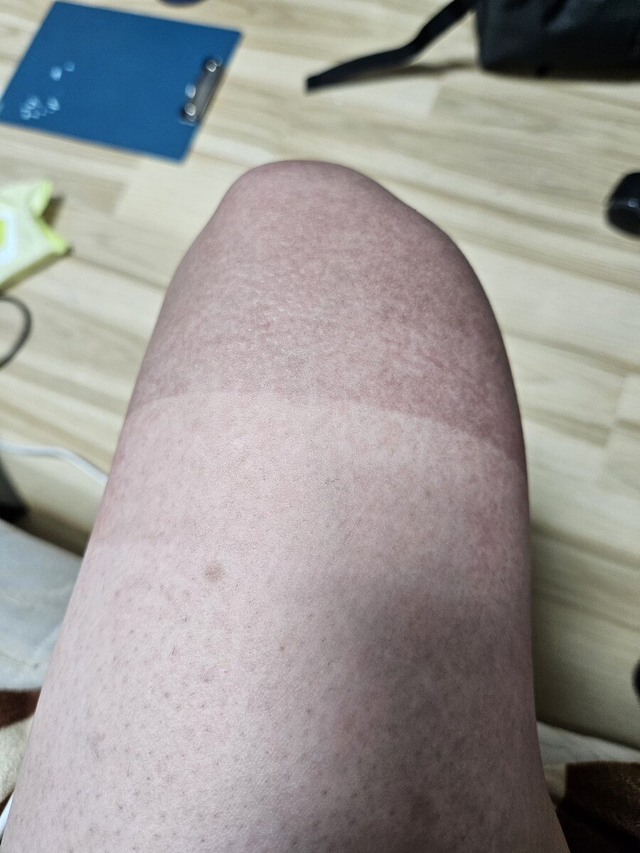 여름에 자전거 탈때 조심해라_1.jpg