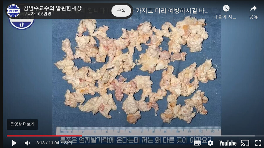 혐) 아프다 아파아아앗_13.jpg