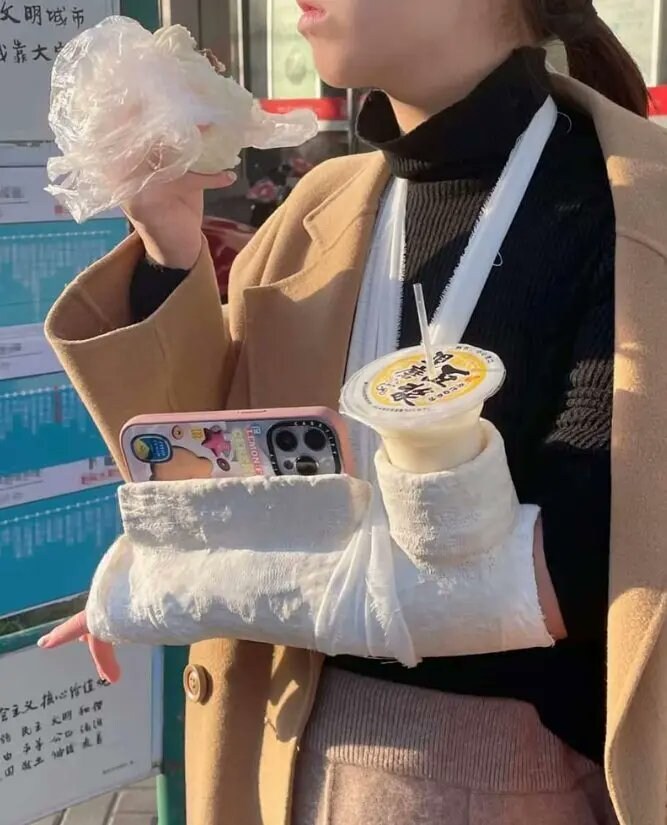 실용적인 깁스.jpg_1.jpg