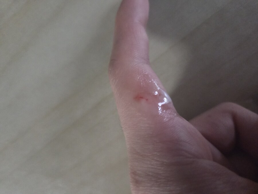 기껏 산 과일도 버리고 손도 다침_1.jpg