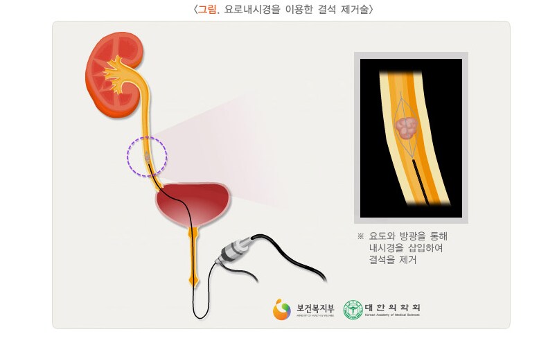 안녕! 나는 물의 요정이야!_1.png