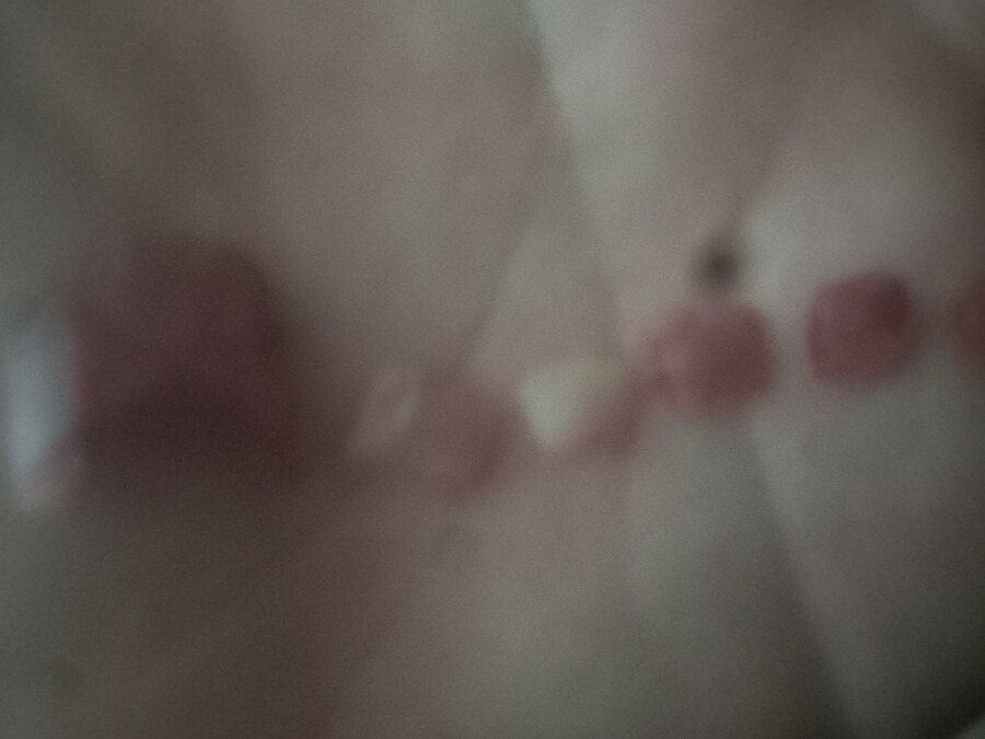 혐) 내성발톱과 ㅈㅌㅍㅇ_7.jpg