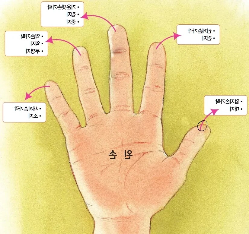 드라이아이스 맨손으로 만져 아픈 부위_1.jpg