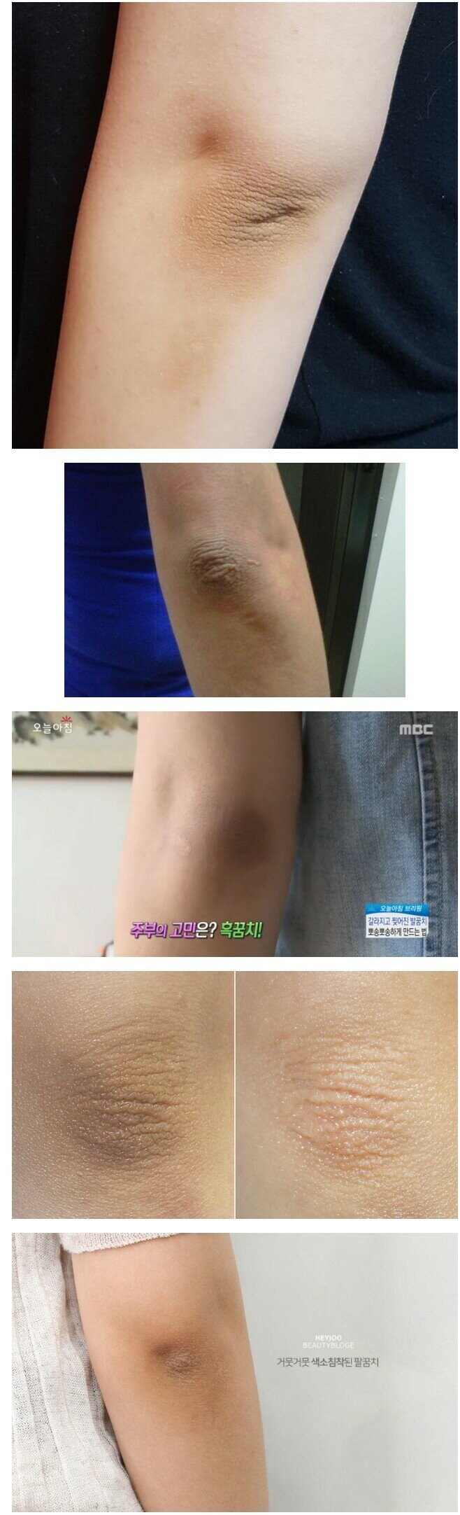 여자들이 은근 신경쓰인다는 부위.jpg_1.jpg