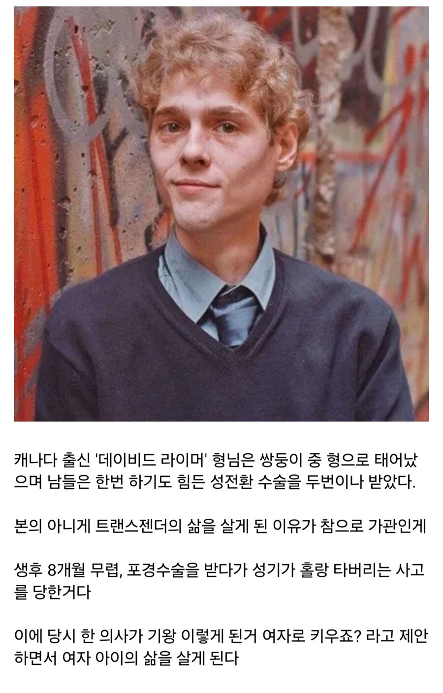 성전환 수술을 두번이나 받은 사나이.jpg_1.jpg