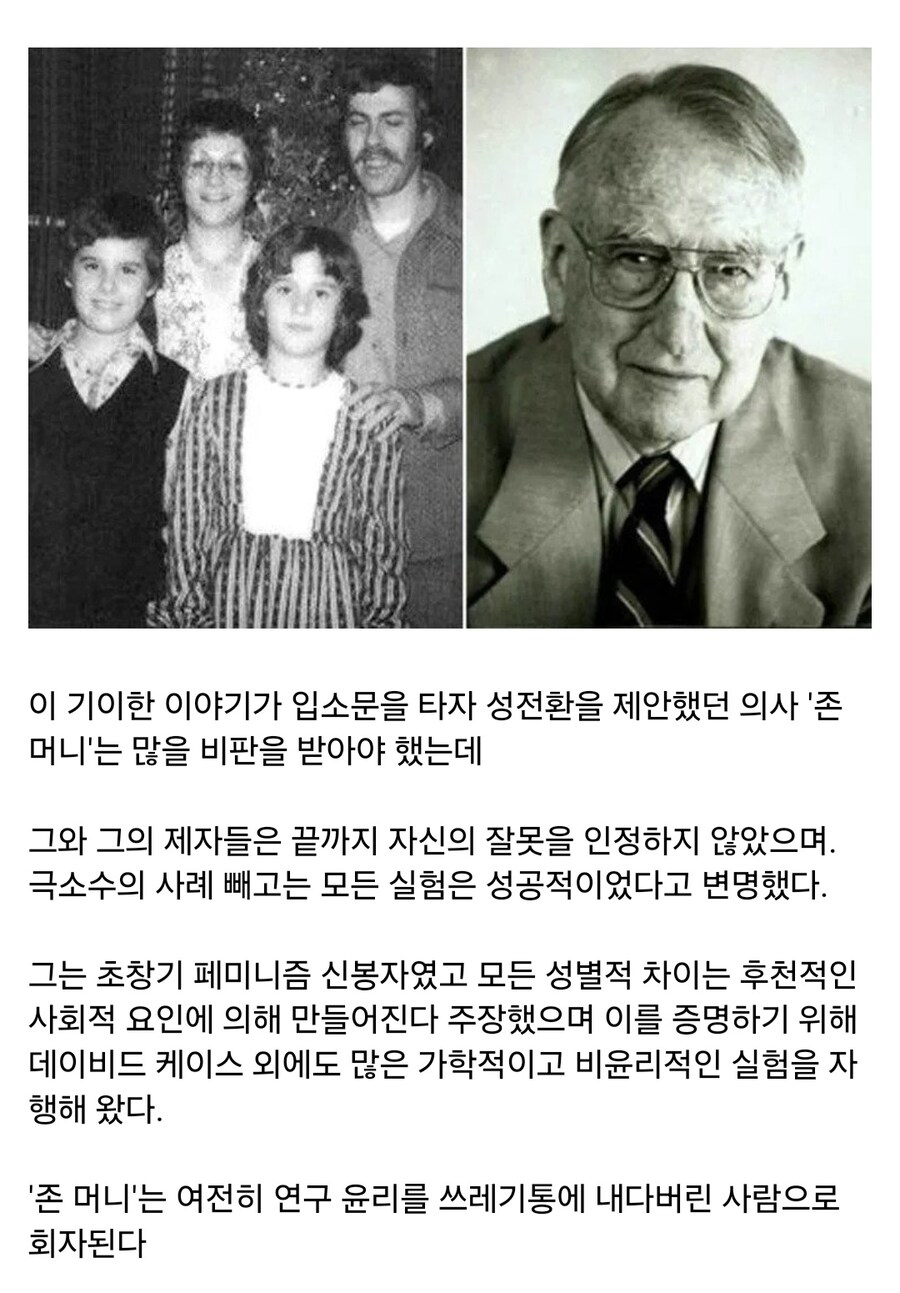 성전환 수술을 두번이나 받은 사나이.jpg_4.jpg