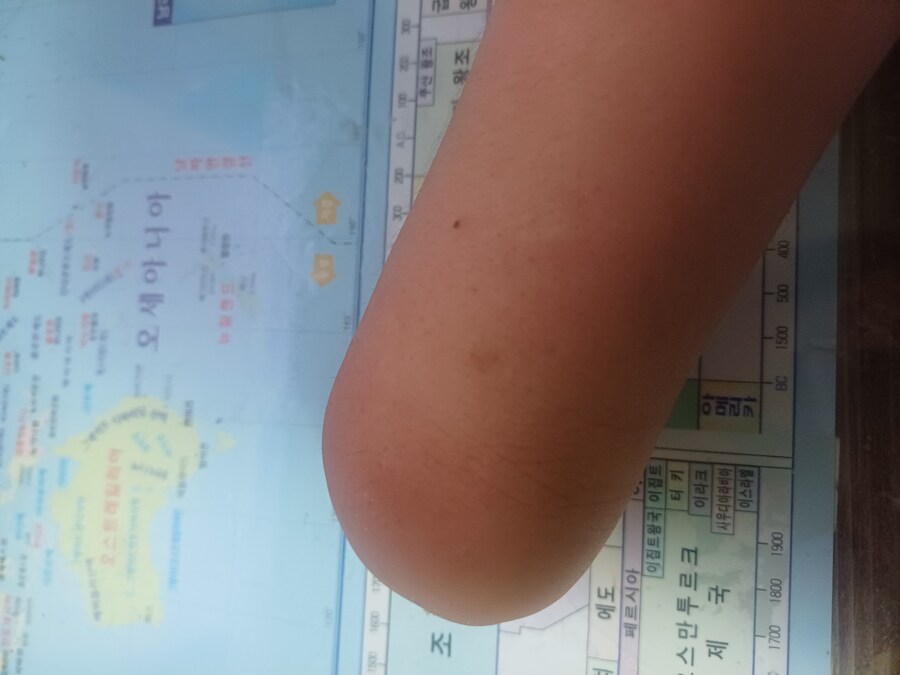 사실 고통스러운 일로 드립치는 것도 조심해야하긴 함._1.jpg