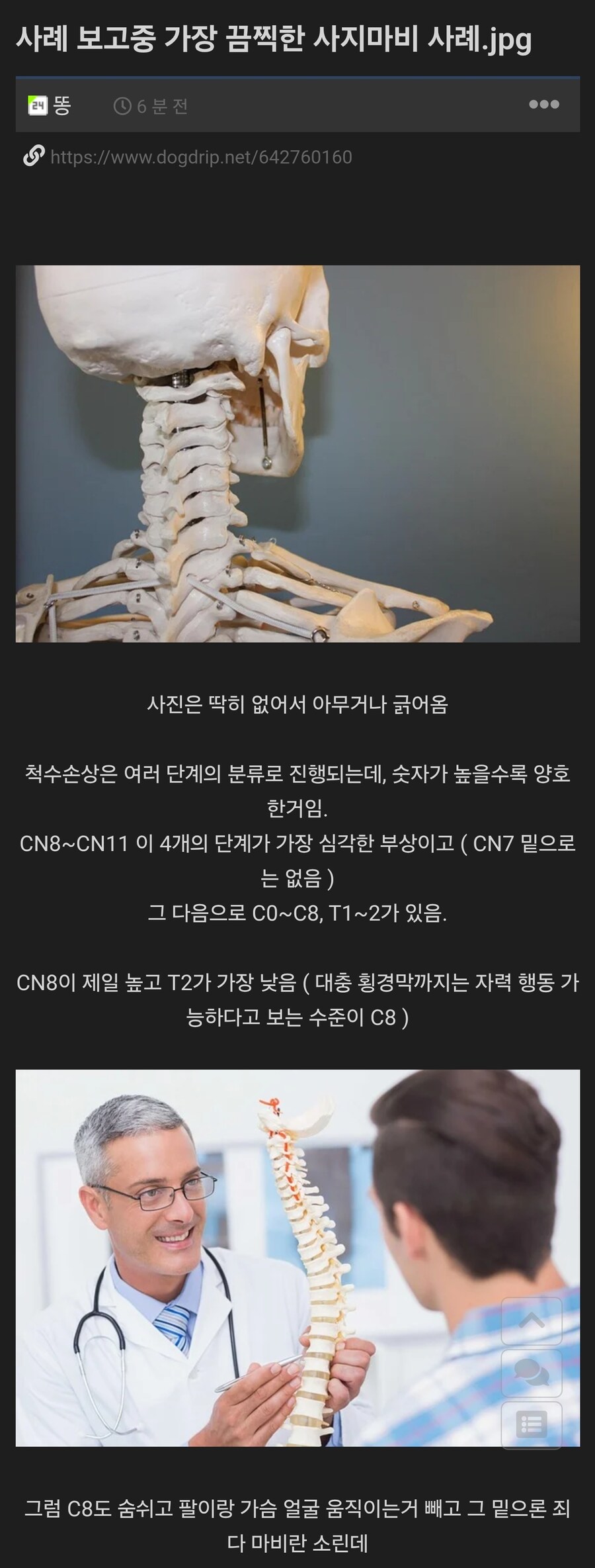 사례 보고중 가장 끔찍한 사지마비 사례.jpg_1.jpg