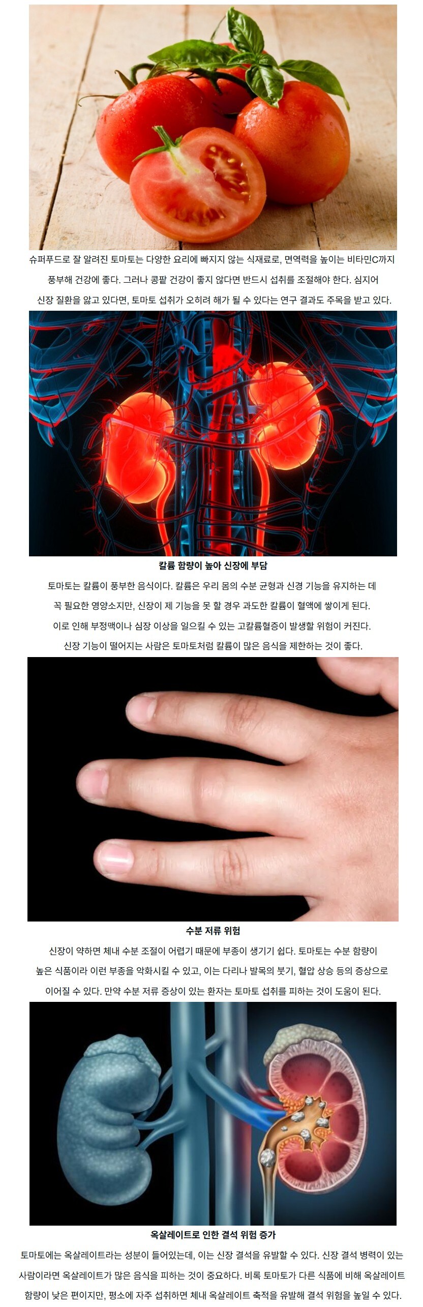 몸에 좋은 토마토, 00이 약하다면 삼가야..._1.jpg