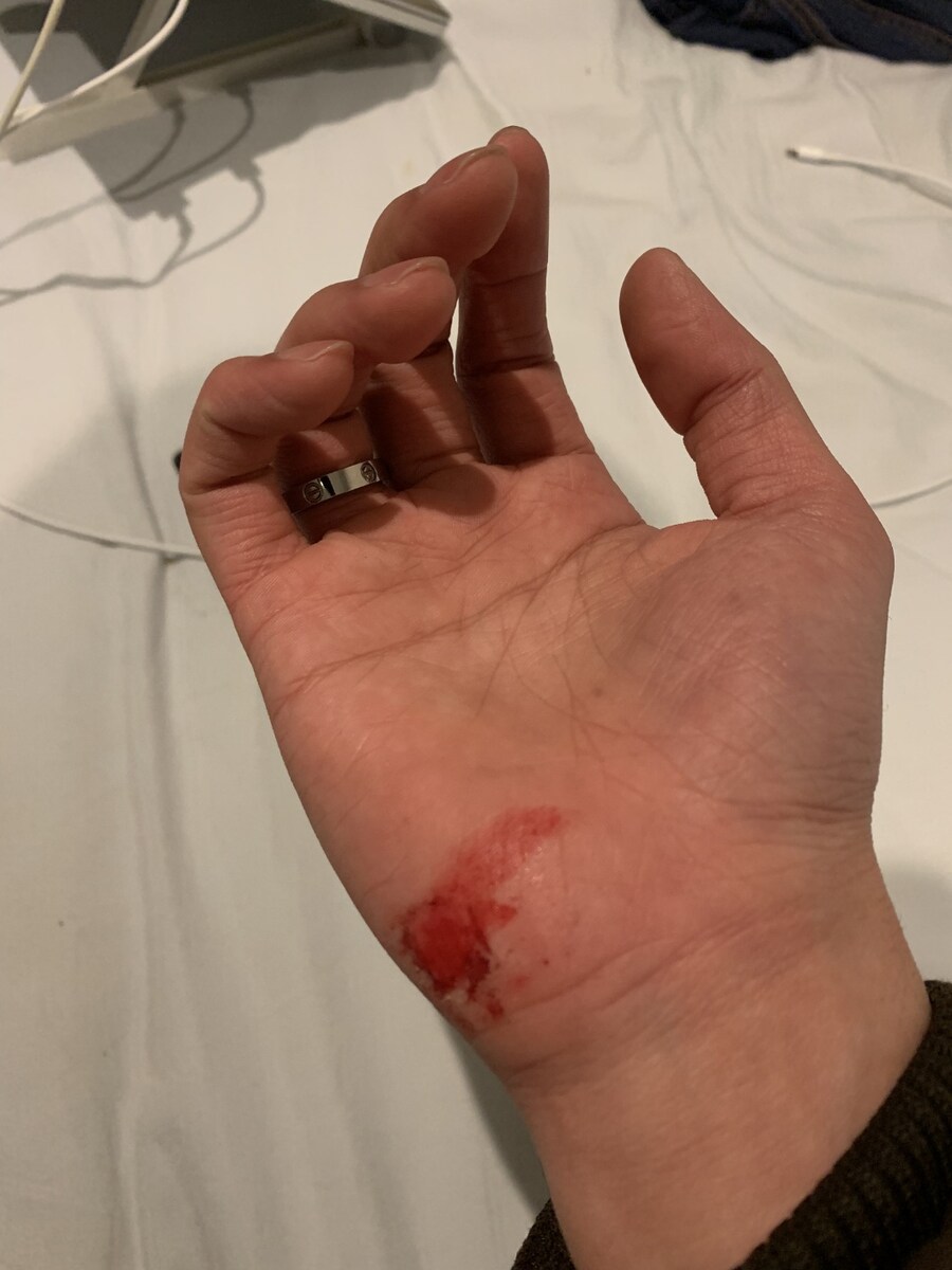 자기 전에 적어보는 거?식?증? 향수?병? 얘기_7.jpg