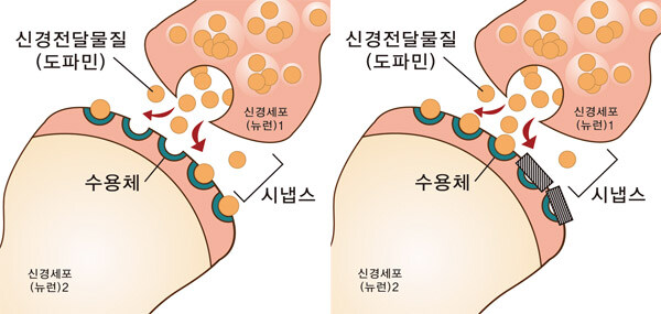 ADHD는 이해하기 쉽게 말하면 "쾌락 불감증"임_1.jpg