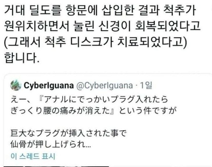 최근 발견된 척추 디스크 치료법_1.png