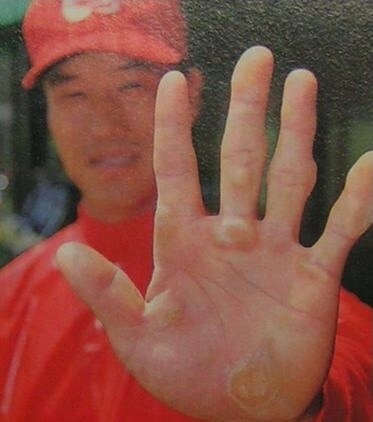 손에 굳은살이 너무 많으면 생기는 일_1.jpg