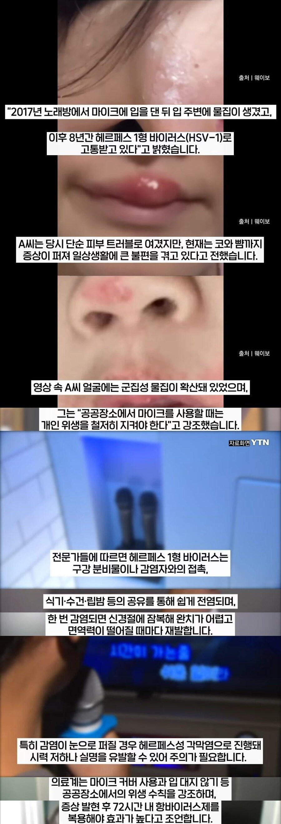 노래방 마이크의 위험성_1.jpg