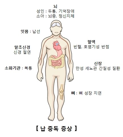 조상들이 유기그릇에 흔한 아연을 안쓰고 비싼 주석을 수입까지한 이유_4.jpg