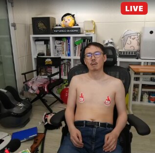 인방) 김도 내상 쌔게 입었네_3.png