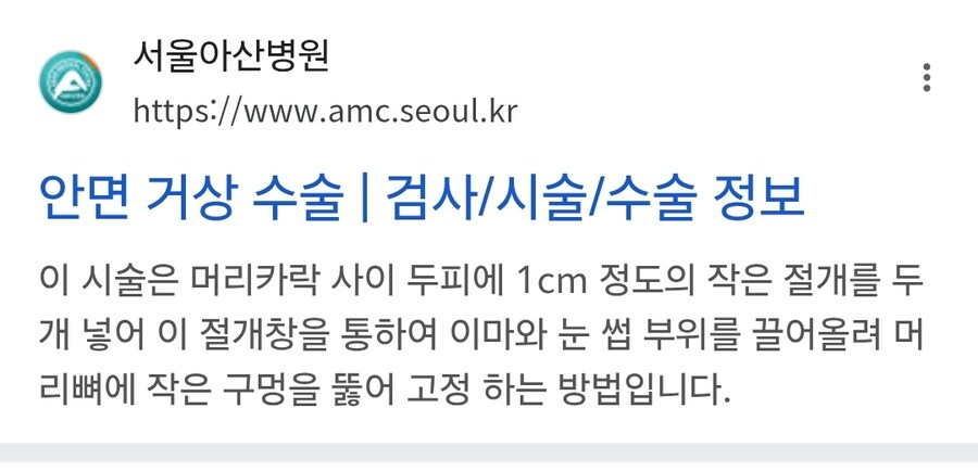성형상담 다녀왔는데_1.jpg
