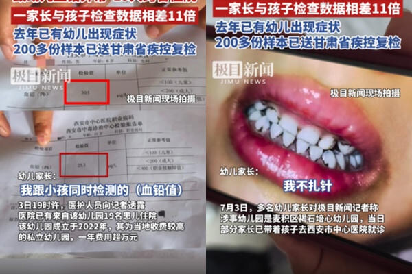 중국 유치원서 단체 납중독 걸려… "머리카락 빠지고 치아 까매져"_1.jpg