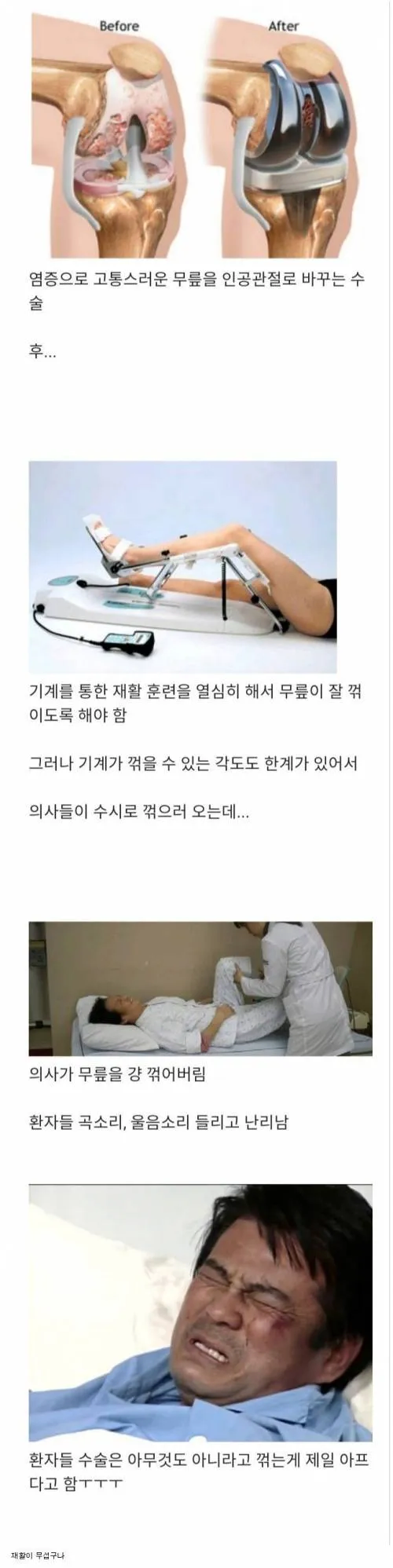 인공관절 수술 후, 환자들 최고의 고통.jpg_1.webp