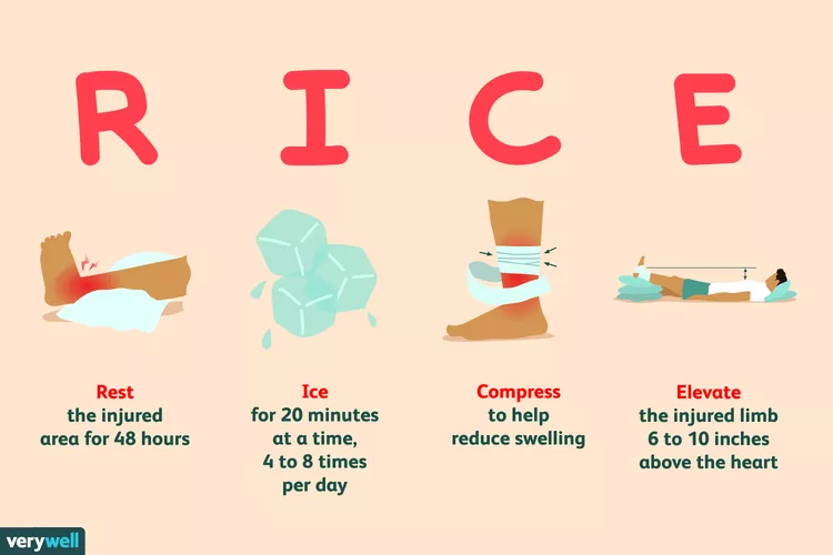 급성 근골격계 질환의 RICE 원칙_1.webp